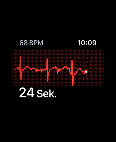 EKG App, Schl?ge pro Minute in der oberen rechten Ecke, Rhythmuslinie, Timer